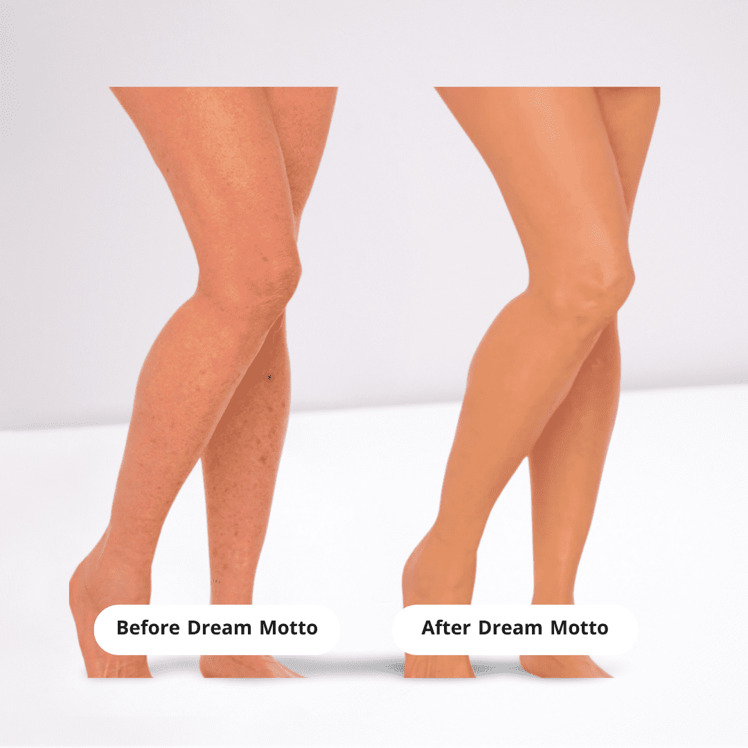 DreamMotto™ Full Body Coverage Perfector-DreamMotto™