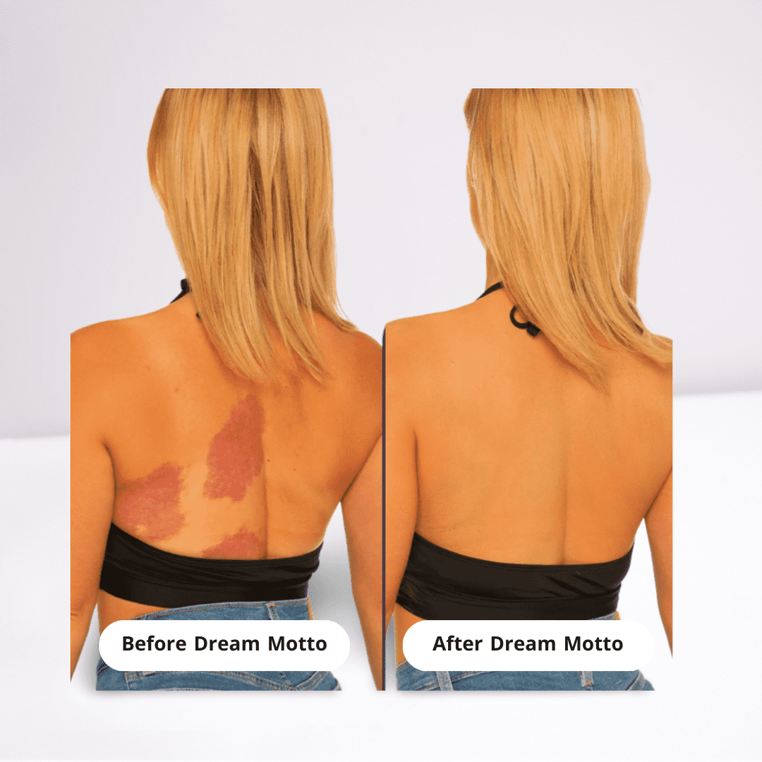 DreamMotto™ Full Body Coverage Perfector-DreamMotto™