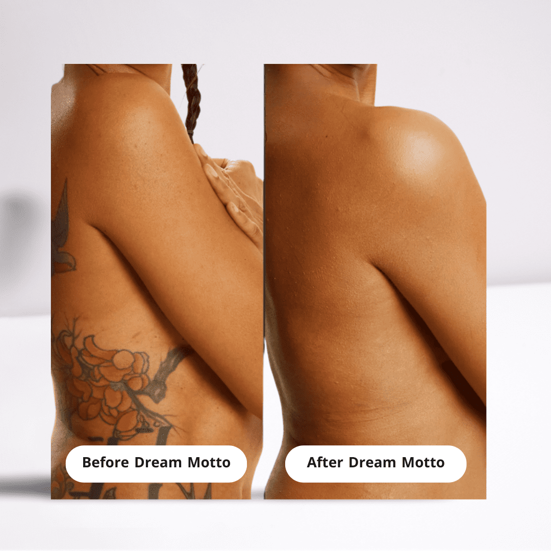 DreamMotto™ Full Body Coverage Perfector-DreamMotto™