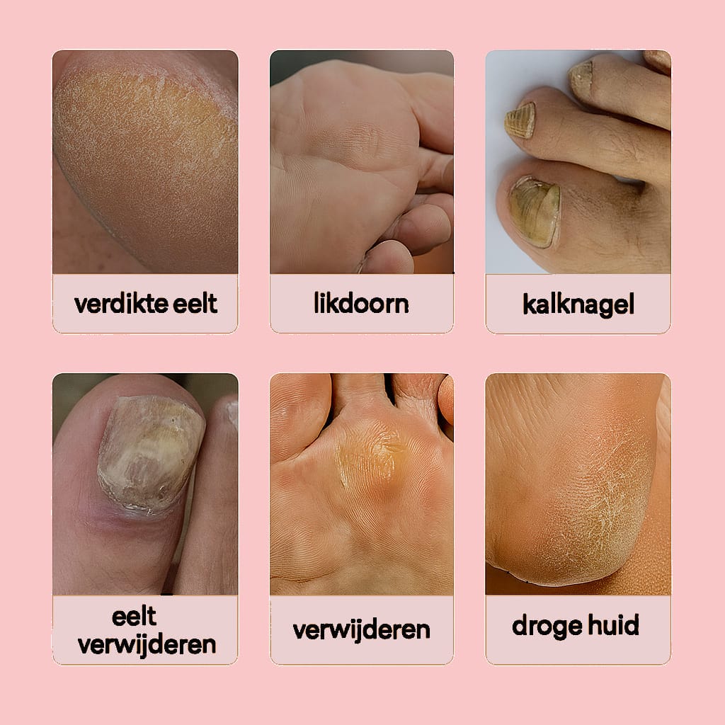 Glowra Glowra™ – Voor Perfect Zachte Voeten in Minuten!