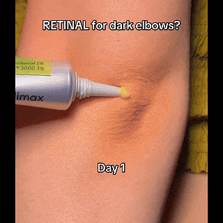 Glowra The Vita A Retinal Shot Tightening Booster & Retinol Serum SET