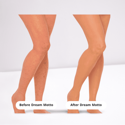 DreamMotto™ Full Body Coverage Perfector-DreamMotto™