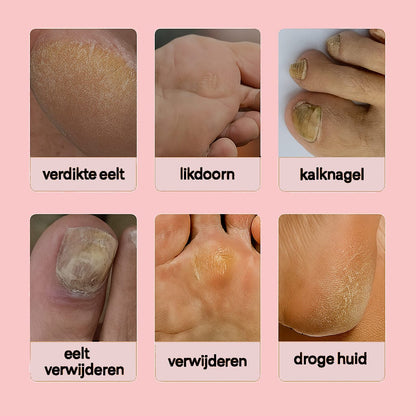 Glowra Glowra™ – Voor Perfect Zachte Voeten in Minuten!
